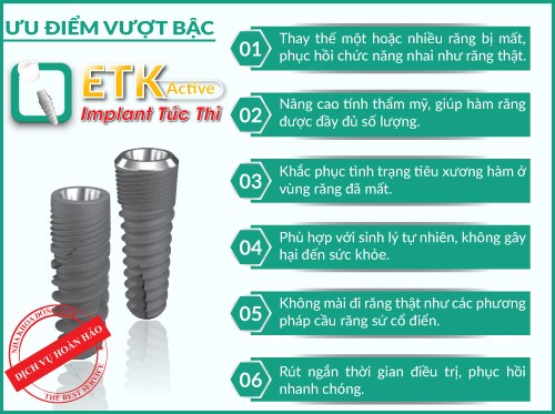 Khuyến mãi khi cấy Implant ETK Active lên răng tức thì